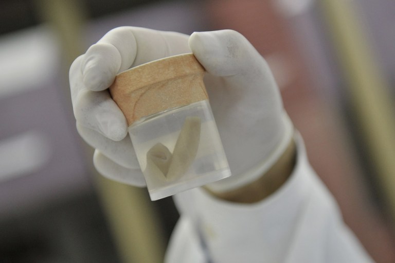 Más allá de un trasplante