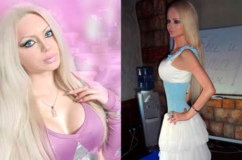 Síndrome de la muñeca Barbie crece en Europa