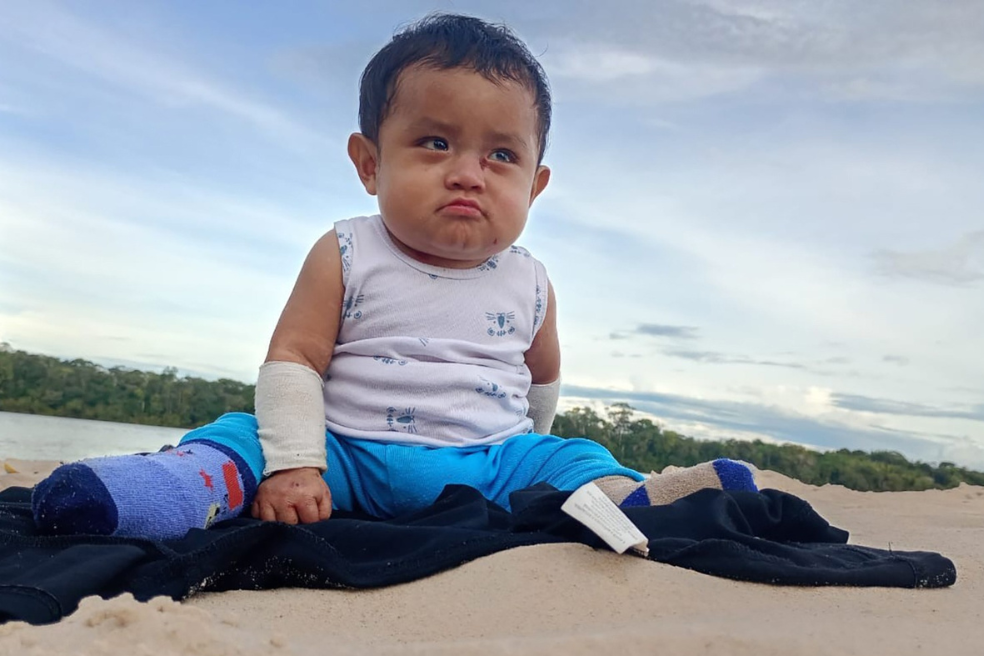 La batalla de Elian, el bebé indígena con piel de mariposa que espera sus medicamentos