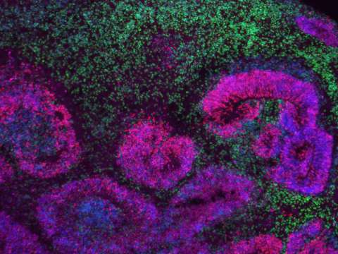 El mayor mapa del cerebro que revela cómo se originan enfermedades como el autismo