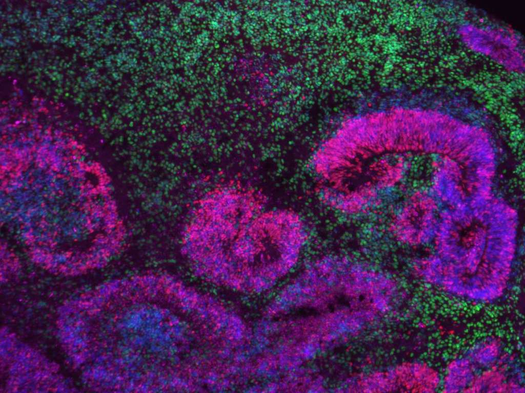 Organoide cortical humano de 8 semanas con estructuras en roseta (rosa y azul) rodeadas de neuronas (verde). Se usaron para estudiar cómo los factores de transcripción determinan tipos celulares de capas profundas. / Nano et al., Nature Neuroscience; Jose Soto, UCLA