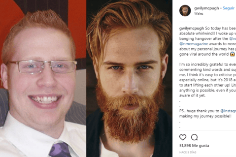 Gwilym Pugh, el hombre que bajó más de 40 kilos y se convirtió en modelo