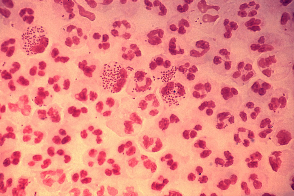 Imagen microscópica de la bacteria causante de la gonorrea. / Wikimedia - Creative Commons / Centers for Disease Control and Prevention's Public Health Image Library