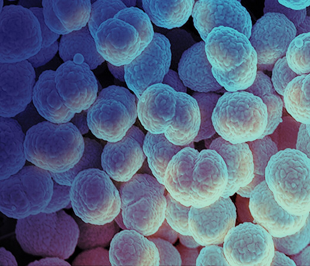 Micrografía electrónica de barrido de la bacteria Neisseria gonorrhoeae, causante de la gonorrea.