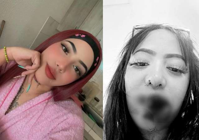 Alejandra Vergara, de 25 años, fue víctima de un intento de feminicidio en Suba.