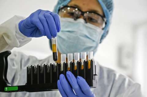 Triglicéridos altos: síntomas que puedes sentir en la piel y en el cuerpo
