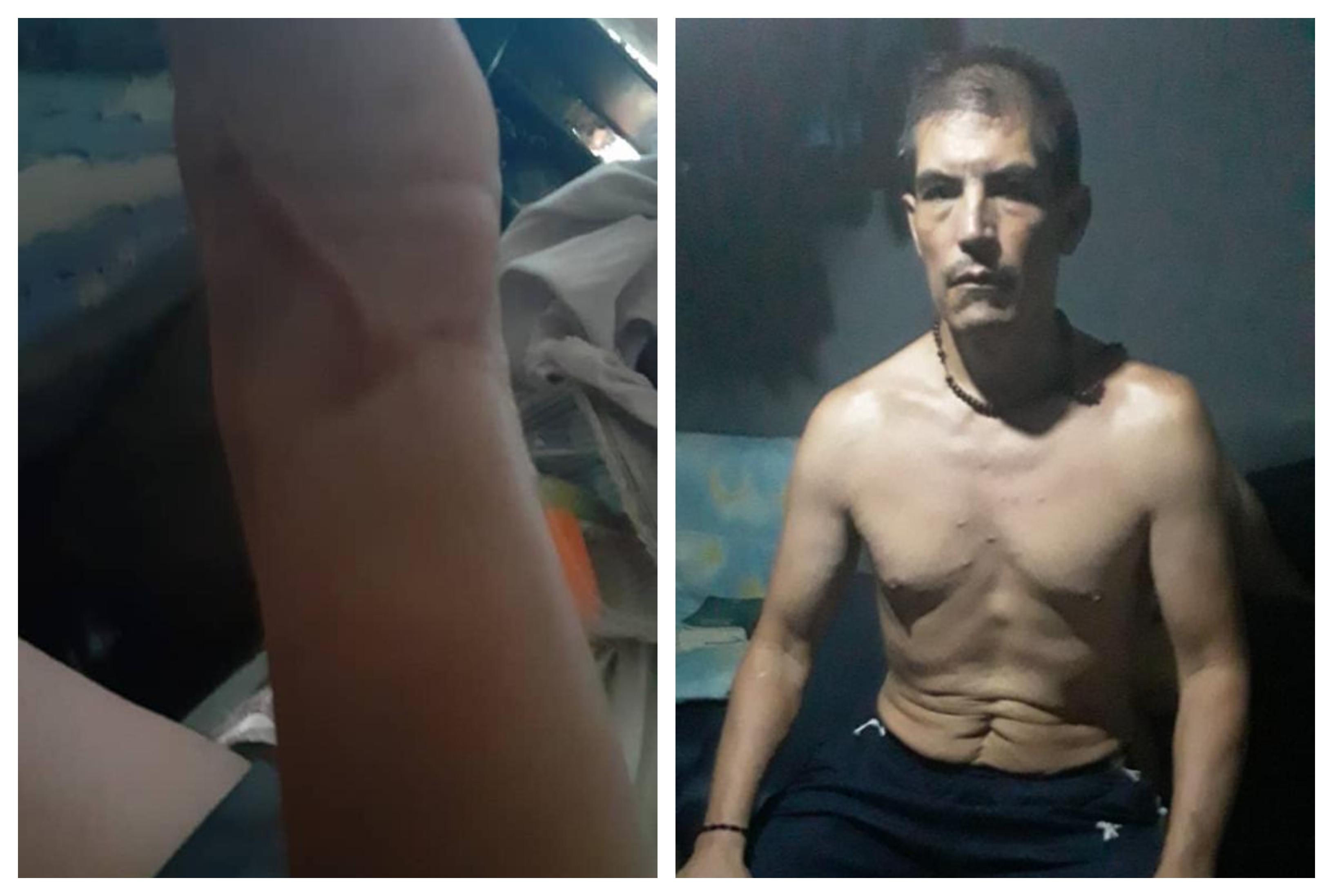 A la izquierda, una de las heridas que fueron inflingidas a los exmilitares presos. A la derecha, Carlos Guerrero, el esposo de Nataly Andrade señalado de magnicidio.