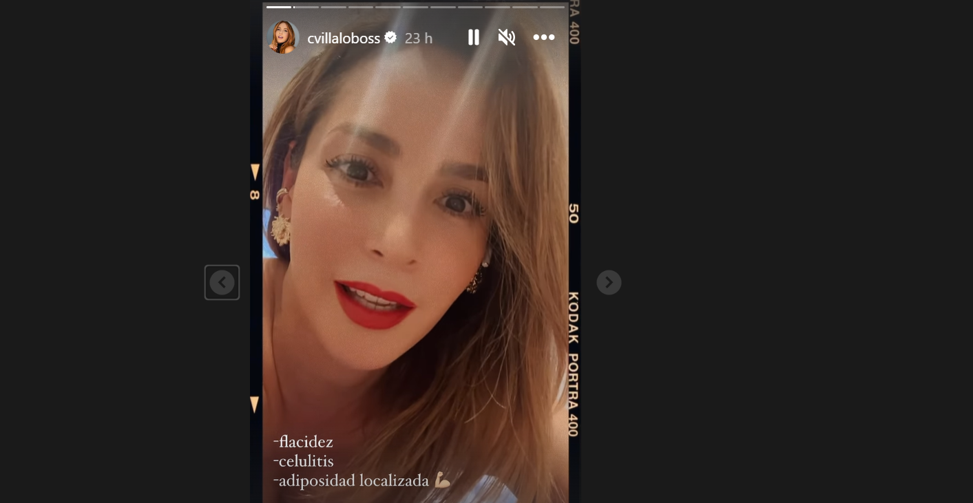 Carmen Villalobos se sometió a particular procedimiento para bajar de peso