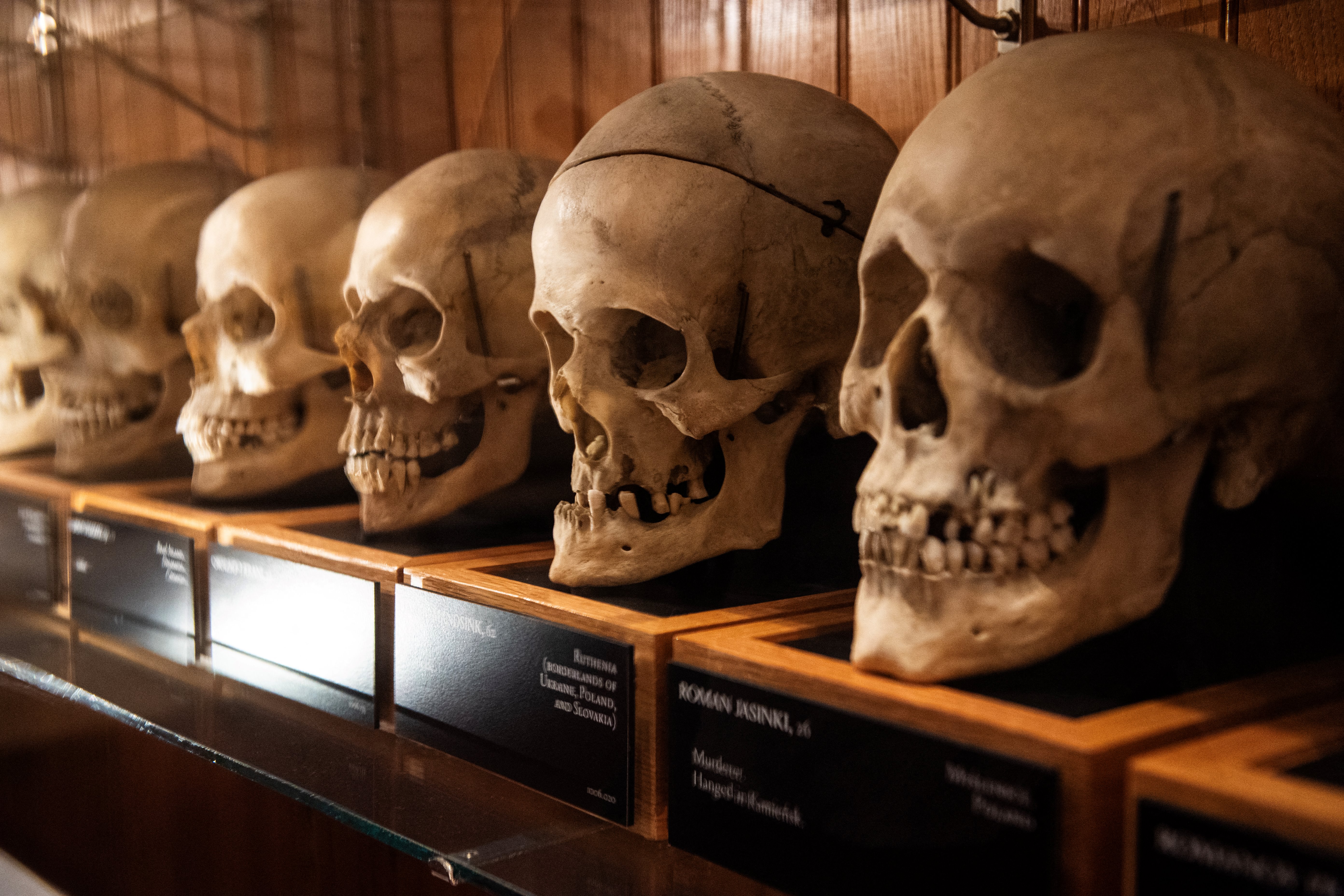 Skulls from the Josef Hyrtl Collection at the Mütter Museum, in Philadelphia, Pennsylvania on August 20, 2025. The collection of 139 human skulls was created by Hyrtl to disprove the claims of Phrenologists that believed cranial features indicated intelligence and personality. The collection was acquired from Hyrtl in 1874 and is one of the main displays at the museum.
