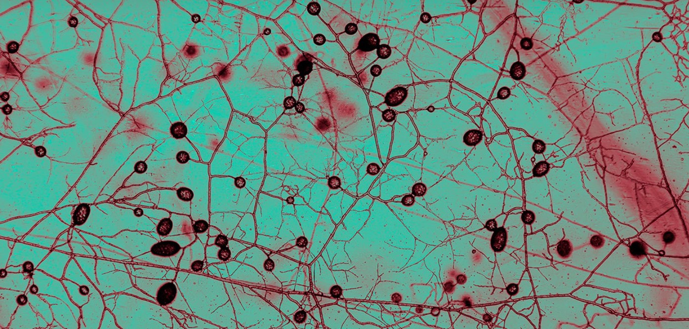 Los investigadores estiman que la capa superficial del suelo a nivel mundial contiene aproximadamente 110 billones de kilómetros de filamentos fúngicos. /Universidad Libre de Ámsterdam.