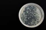 Un virus ayudó a una mujer a superar una infección bacteriana multirresistente