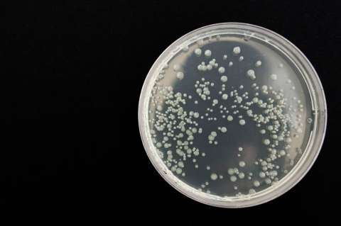 Científicos descubren que existe un vínculo entre cambio climático y bacterias resistentes