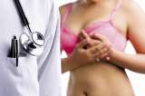 Estudio revela cuatro tipos de cáncer de mama