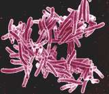 En busca de los genes de la tuberculosis que sufren los caldenses