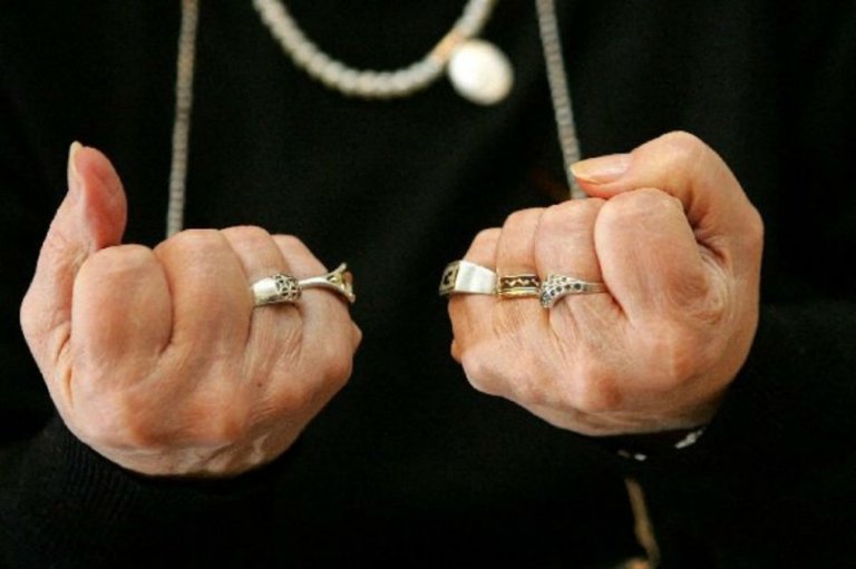 Este jueves es el día mundial de la artritis reumatoide