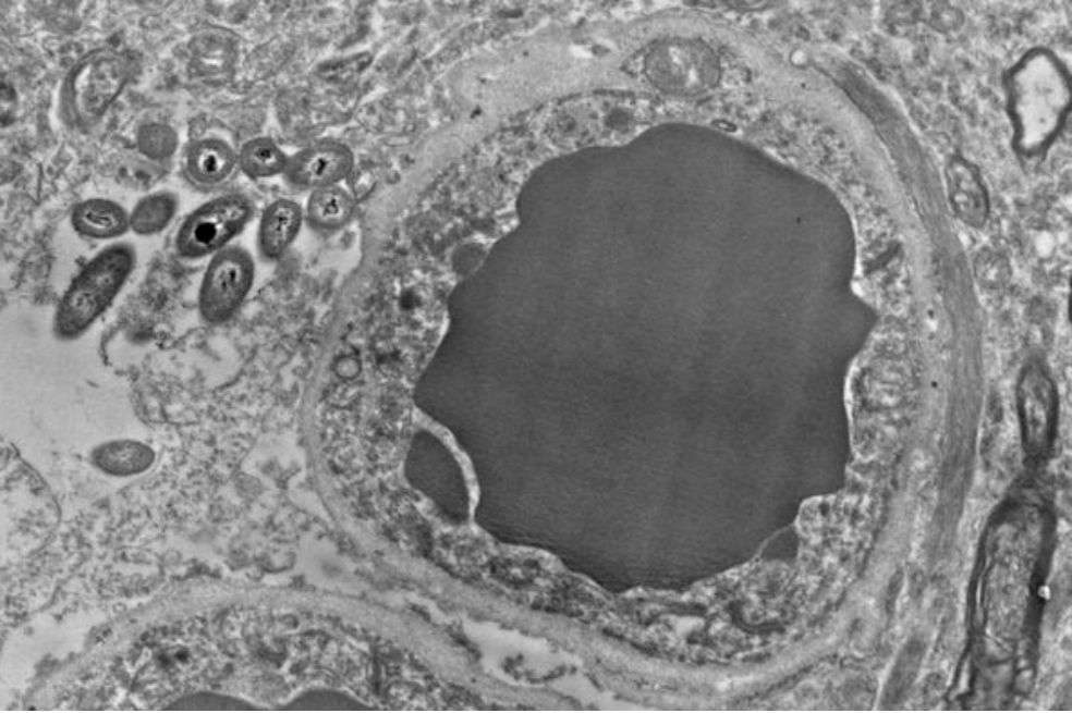 A la izquierda de un vaso sanguíneo se observan las bacterias, una imagen que sería evidencia tentadora pero preliminar de un "microbioma cerebral". / Rosalinda Roberts, Courtney Walker y Charlene Farmer