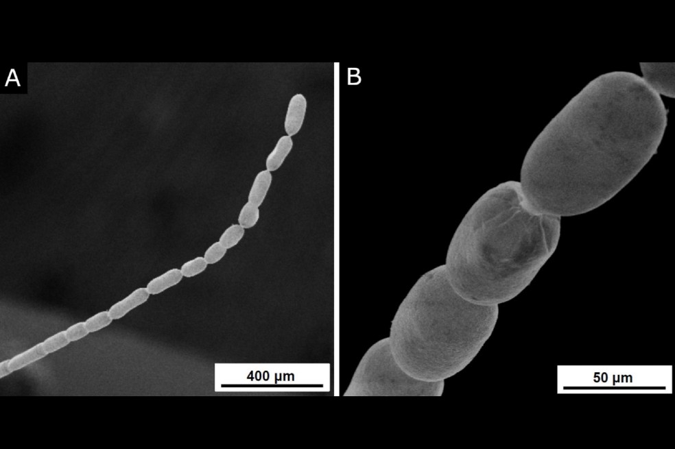 Los investigadores propusieron que esta nueva bacteria se llamara T. magnifica