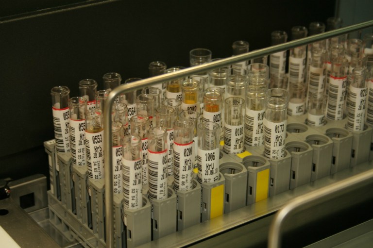 Investigadores buscan en la orina tratamientos para diabetes y parkinson