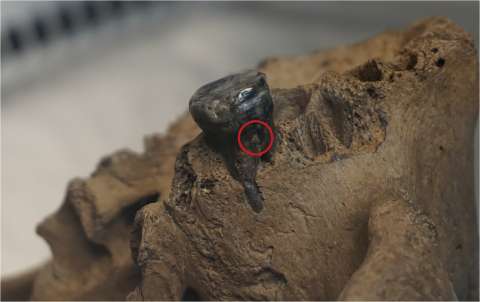 El sarro de un diente de 140.000 años ayuda a resolver el misterio de los denisovanos
