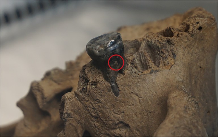 El sarro de un diente de 140.000 años ayuda a resolver el misterio de los denisovanos
