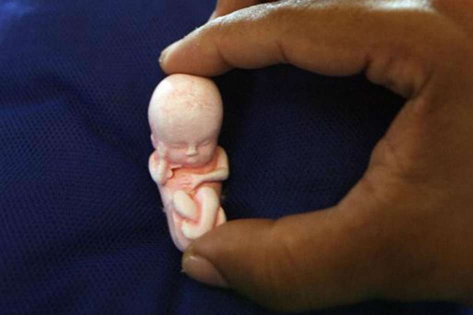 Una figura que representa un feto de tres meses