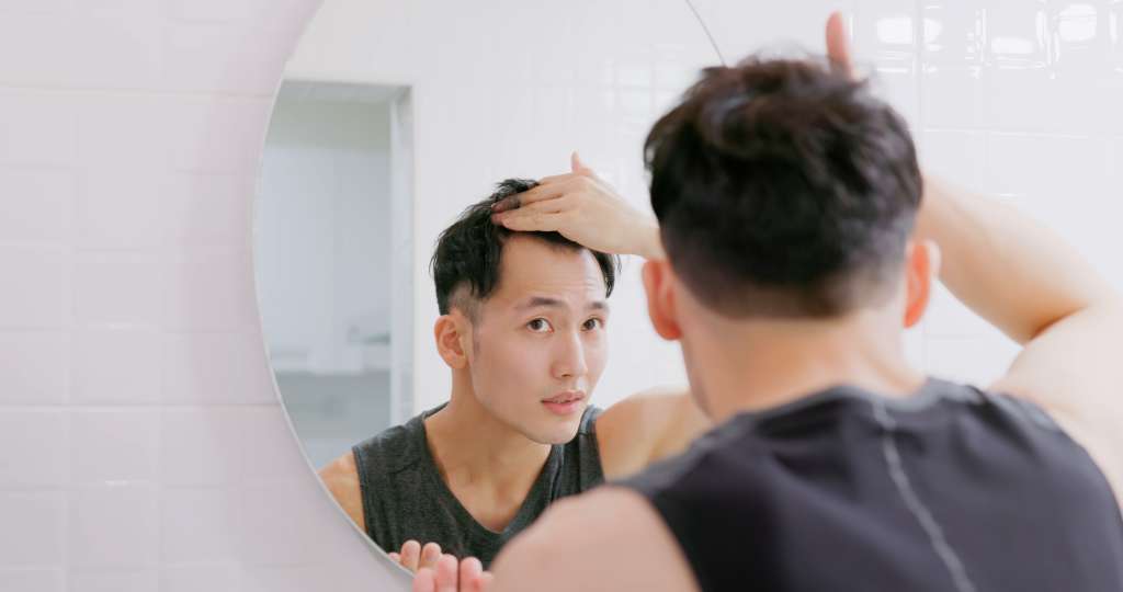 Hombre con entradas en el cabello.