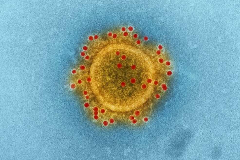 Fotografía de un coronavirus. / Créditos: National Institute of Allergy and Infectious Diseases (NIAID)