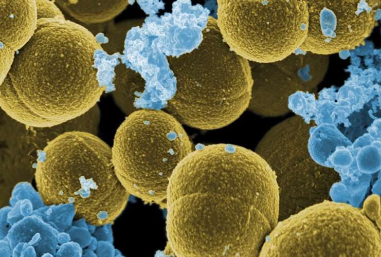Imagen del "Staphylococcus aureus", que causó 130 mil muertes en 2021.