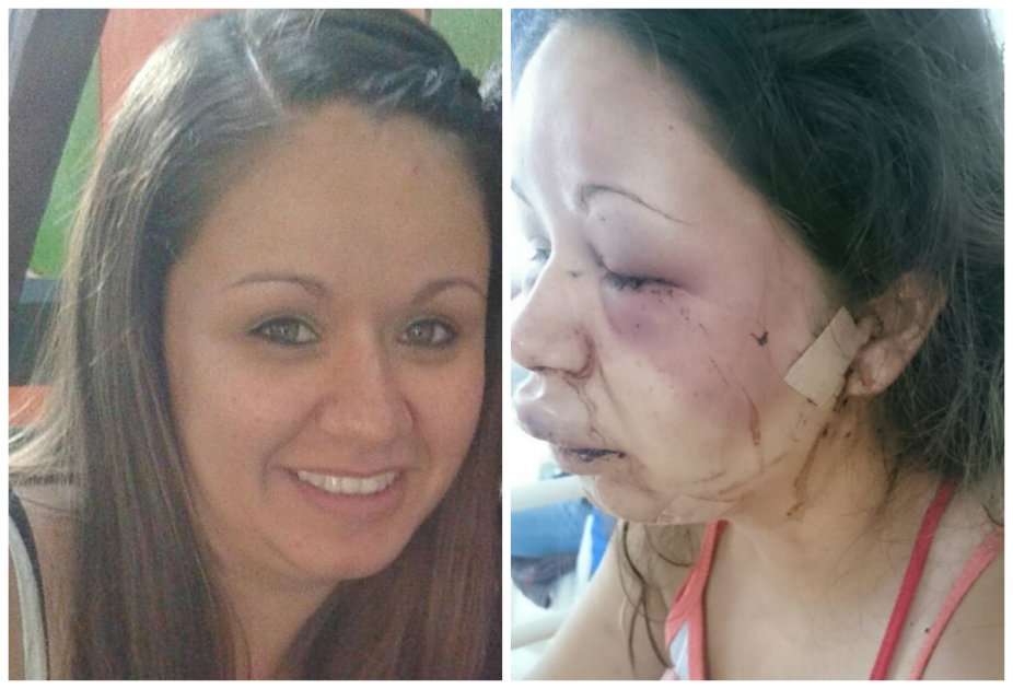 Dary Johana Rivero, de 28 años, fue agredida por su pareja sentimental en Armenia  / Cortesía