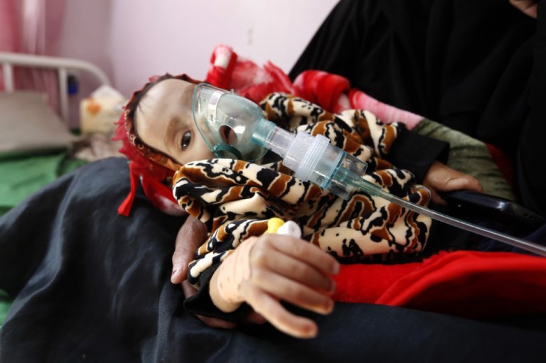 ¿Qué es lo que pasa en Yemen?
