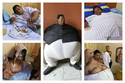 El duro desafío del colombiano más obeso