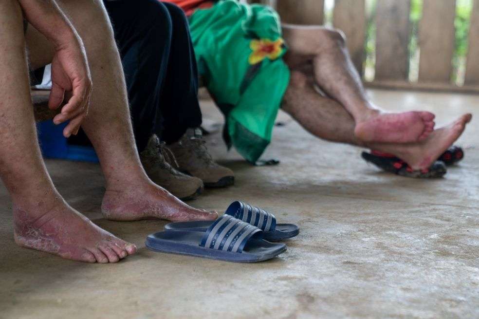 A finales de julio de 2021, unos 8.000 migrantes estaban atrapados en Necoclí (Colombia) a la espera de iniciar su viaje por el Darién.