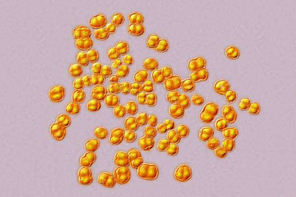 El meningococo (nombre común) o Neisseria meningitidis (nombre científico) es una bacteria que puede causar una forma grave de meningitis, llamada meningitis meningocócica./Getty