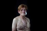 Mujer trans víctima de biopolímeros: “Siempre serás Yomaira, nunca serás Hernando”