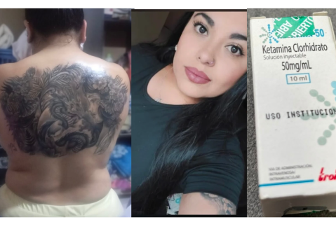 Mujer murió tras sedación para un tatuaje en Bogotá: videos y medicamentos claves