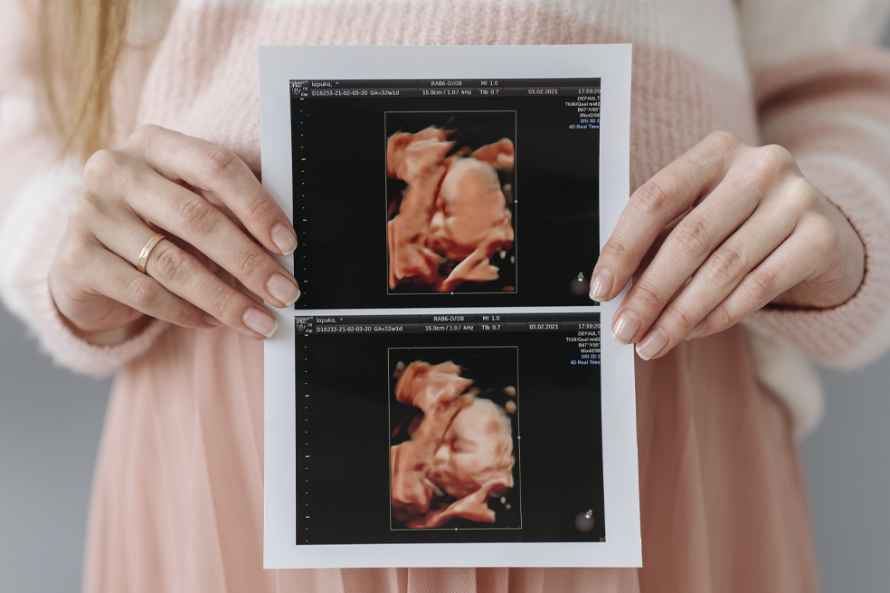 Dentro de las primeras semanas de gestación ocurren grandes cambios en el cuerpo de la madre. Conoce aquí lo que pasa en el primer mes de embarazo.