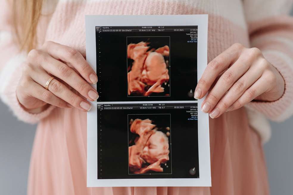 Dentro de las primeras semanas de gestación ocurren grandes cambios en el cuerpo de la madre. Conoce aquí lo que pasa en el primer mes de embarazo.
