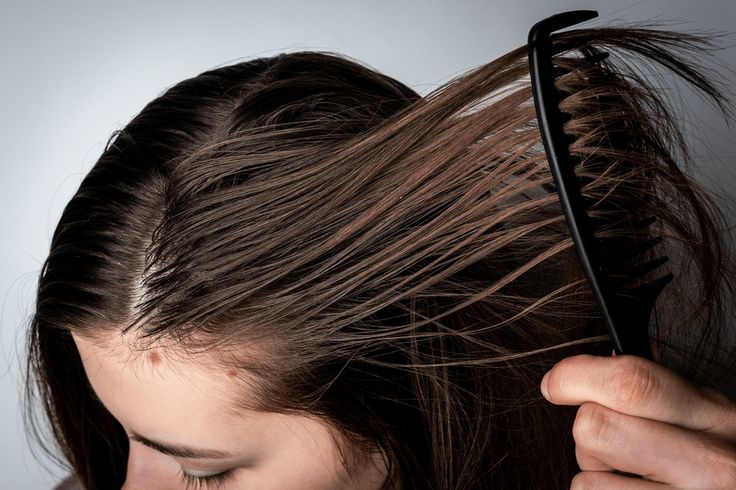La necesidad de cuidar el cabello graso es fundamental para mantener un cuero cabelludo saludable y un cabello brillante.