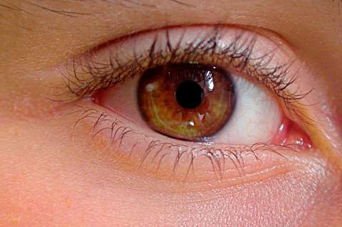 ¿Cuáles son los síntomas del ojo seco? Influencer fue al hospital por caso severo