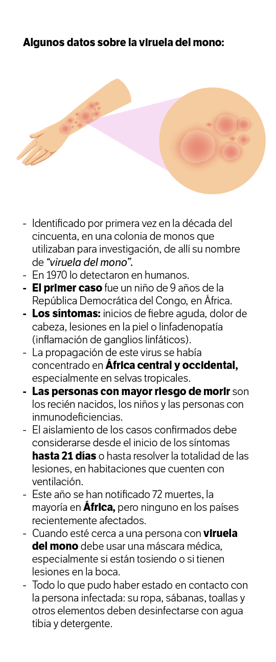 Algunos datos sobre la viruela del mono.