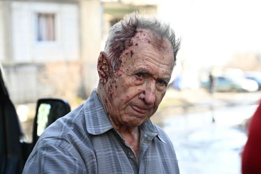 Un hombre herido se encuentra junto a un vehículo de una unidad de emergencia para recibir asistencia médica después de los bombardeos en la ciudad de Chuguiv, en el este de Ucrania.