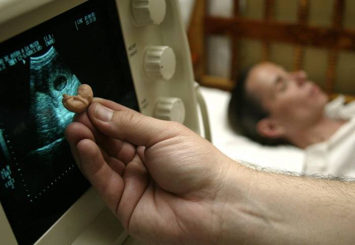 Por malformaciones del feto, interrumpen embarazo de mujer infectada con zika