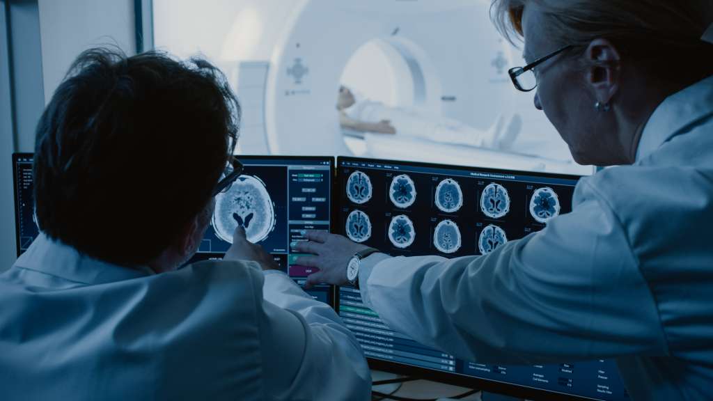 Imágenes cerebrales.