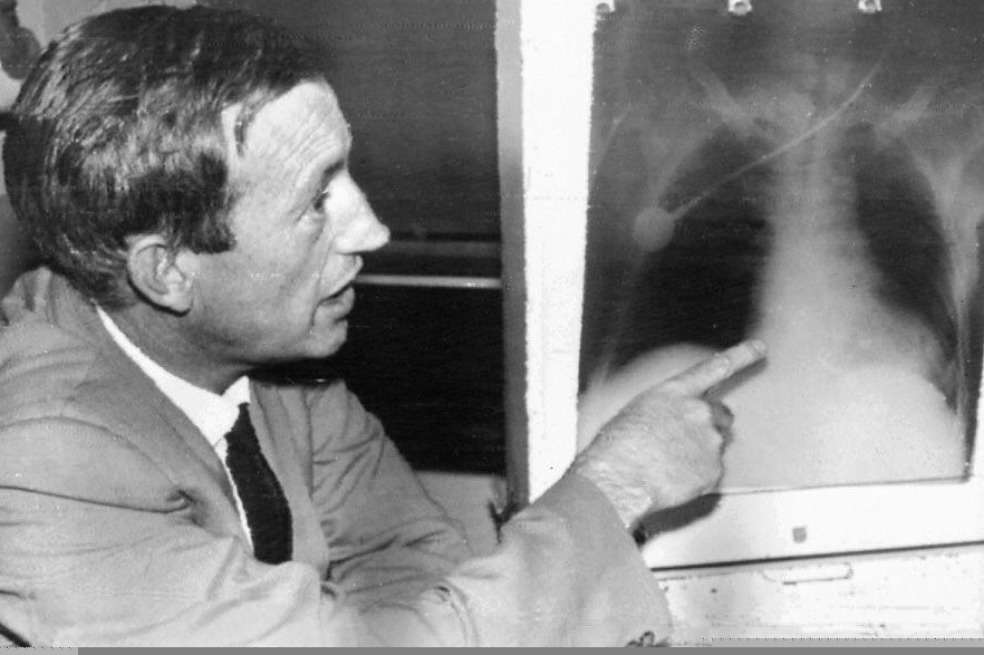 Esta foto de archivo tomada el 1 de diciembre de 1992 en Ciudad del Cabo muestra al cirujano sudafricano Christiaan Barnard mostrando la radiografía de Louis Washkansky a quien se le dio el corazón de un hombre de 25 años en la primera operación exitosa de trasplante de corazón humano realizada en Groote, hospital Schuur en Ciudad del Cabo. / AFP