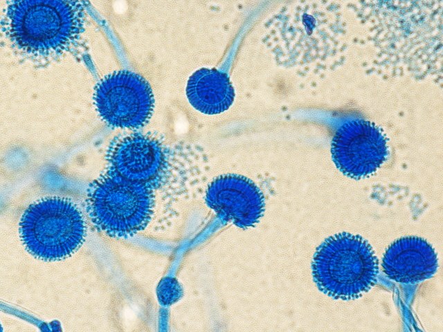 Las infecciones por hongos también tuvieron un papel en la pandemia del covid-19