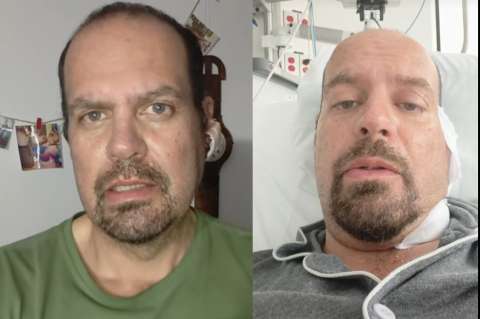 Andrés Bejar se recupera luego de su cirugía por tumor cancerígeno: “muy dolorosa”