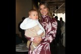 Foto: Laura Tobón mostró la lesión benigna con la que nació su hijo Lucca