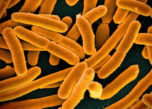Imagen de bacterias "Escherichia coli", que pueden causar Enfermedad Diarreica Aguda.