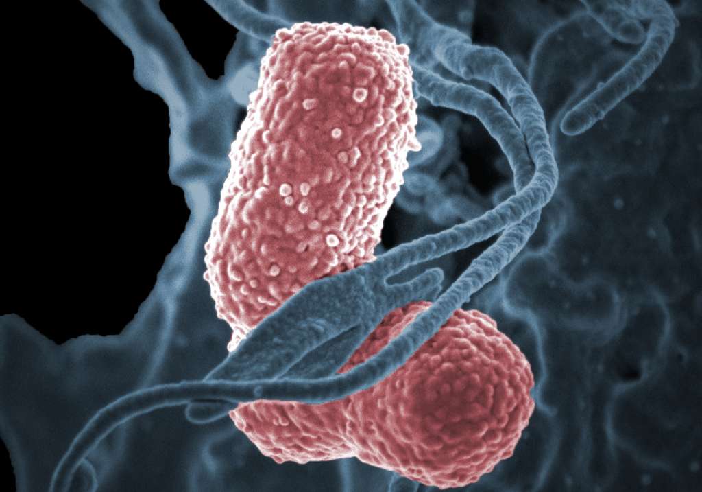Imagen de una "Klebsiella pneumoniae".