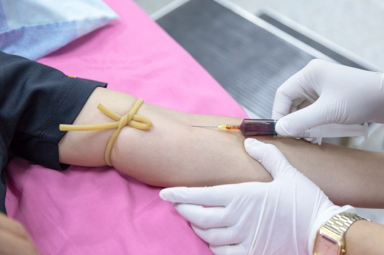 Dos pacientes son los primeros en recibir sangre cultivada en un laboratorio